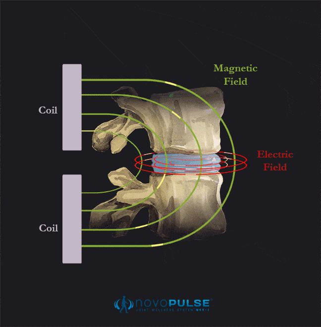 Joint Wellness (Novo Pulse) Belleview FL Simulation Joint Wellness (Novo Pulse) Belleview FL Simulation